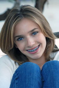 photo of teen with braces