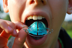 photo of boy inserting oral retainer